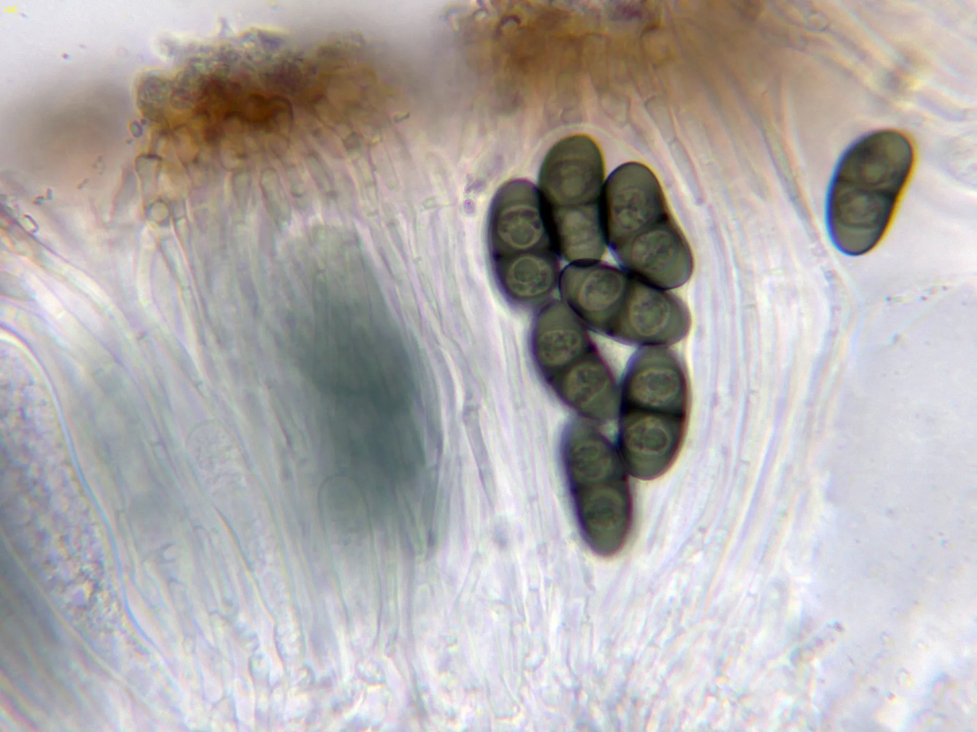 Microscopía de Physcia aipolia - 10 - Asco agua-001